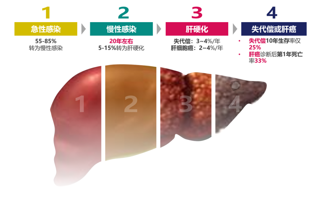 悄悄变成肝硬化、肝癌，很多人感染了却不知道
